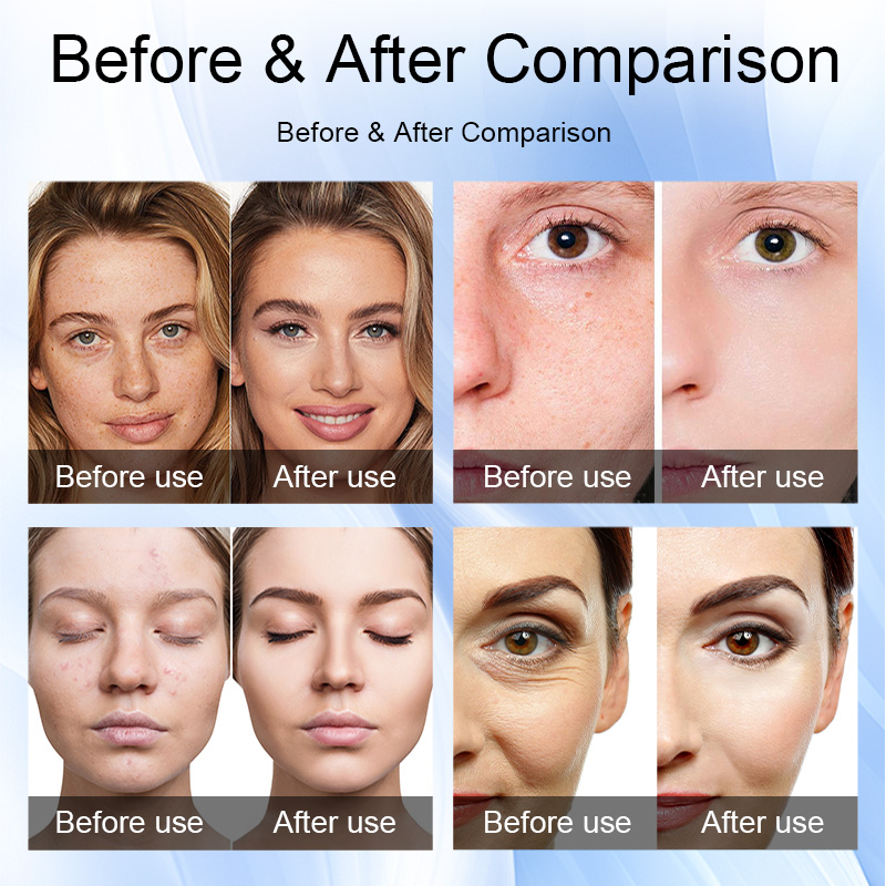 2Professional Nano Mesotherapy Sprayer for Skin Rejuvenation